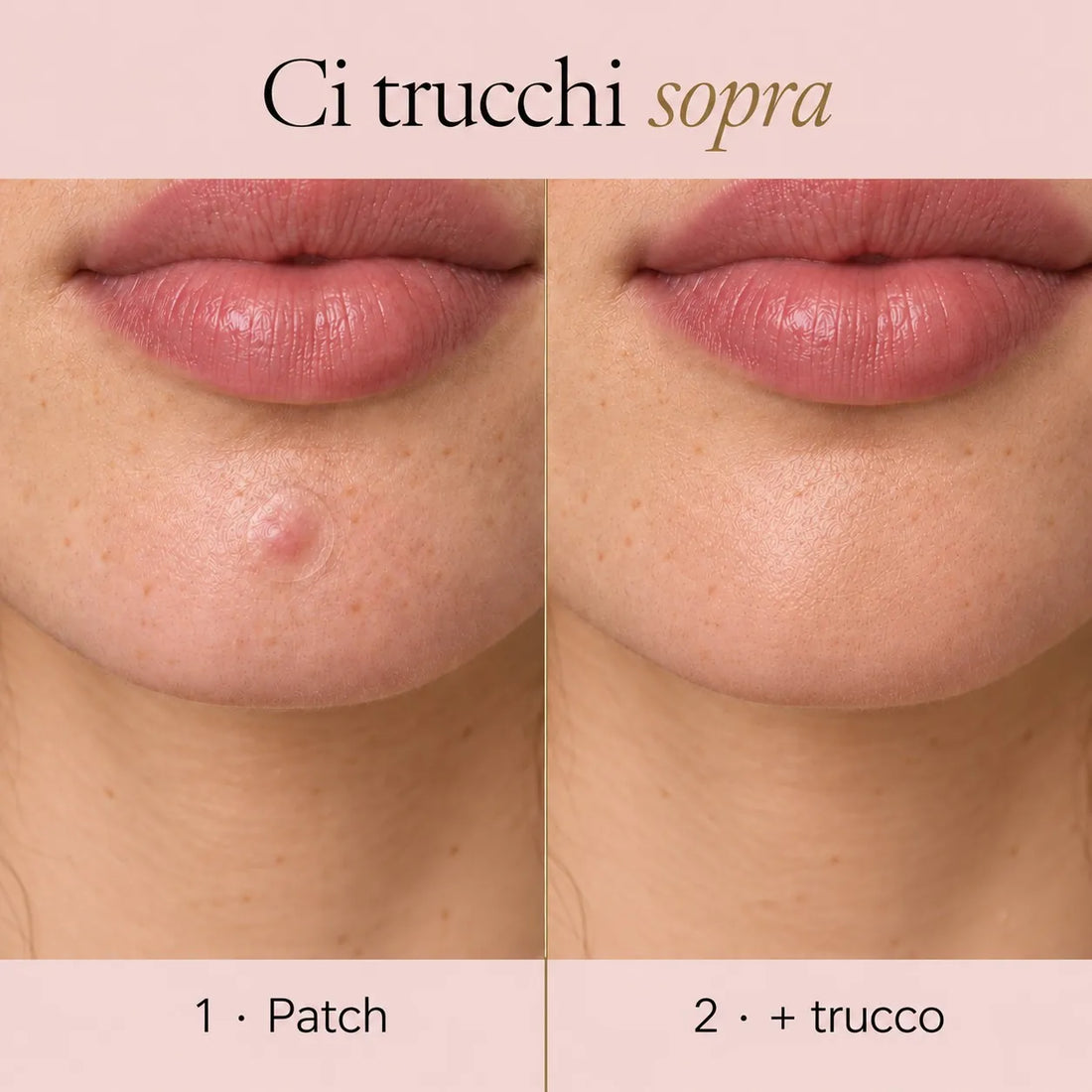 Prima il patch sul brufolo, poi il trucco sopra